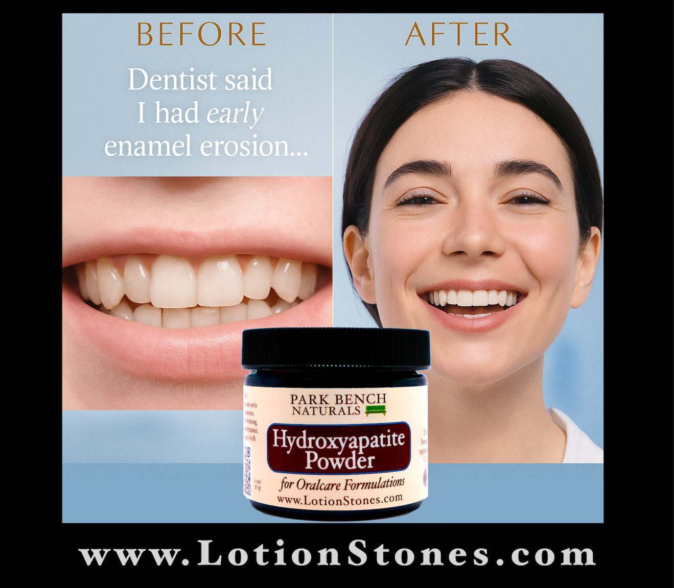 Dentist said I had early enamel erosion hydroxyapatite was the answer